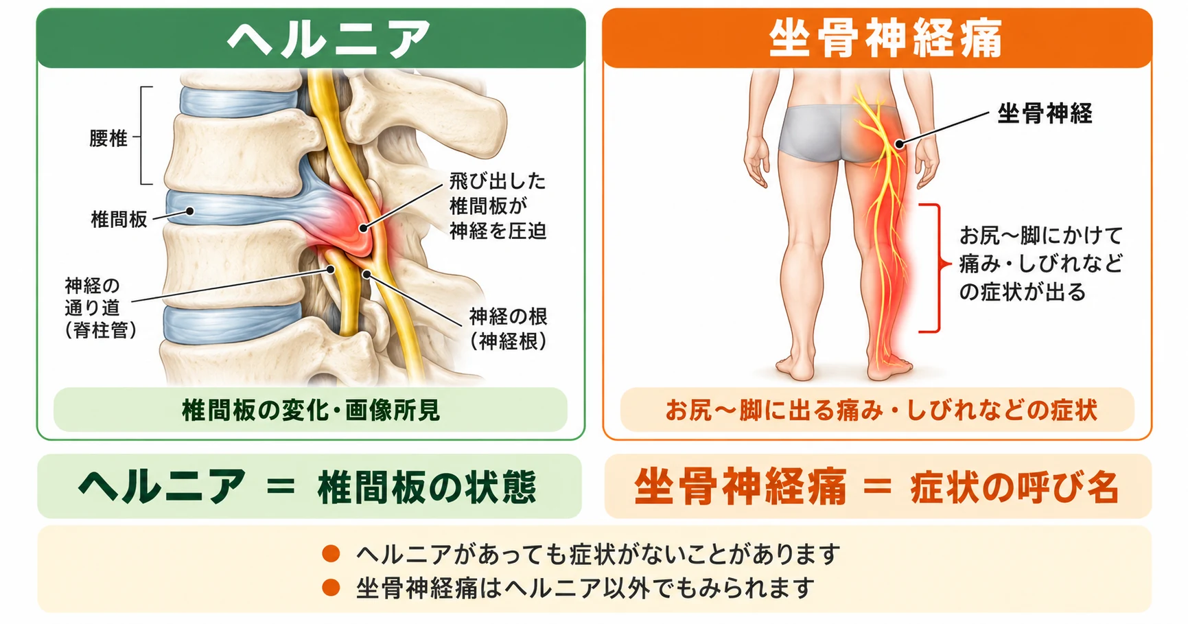 腰椎椎間板ヘルニアの画像所見と坐骨神経痛によるお尻から脚の痛み・しびれの違いを示した解剖図