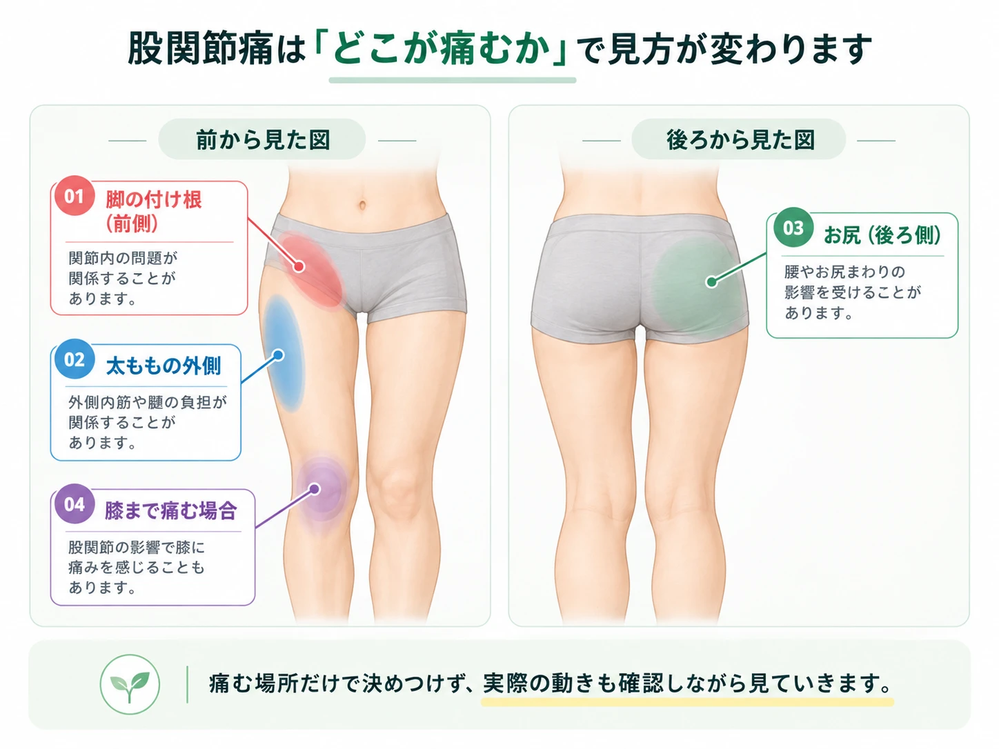 股関節痛を感じる場所を正面・背面の図で整理。鼠径部、太ももの外側、お尻、膝の4か所を色分け