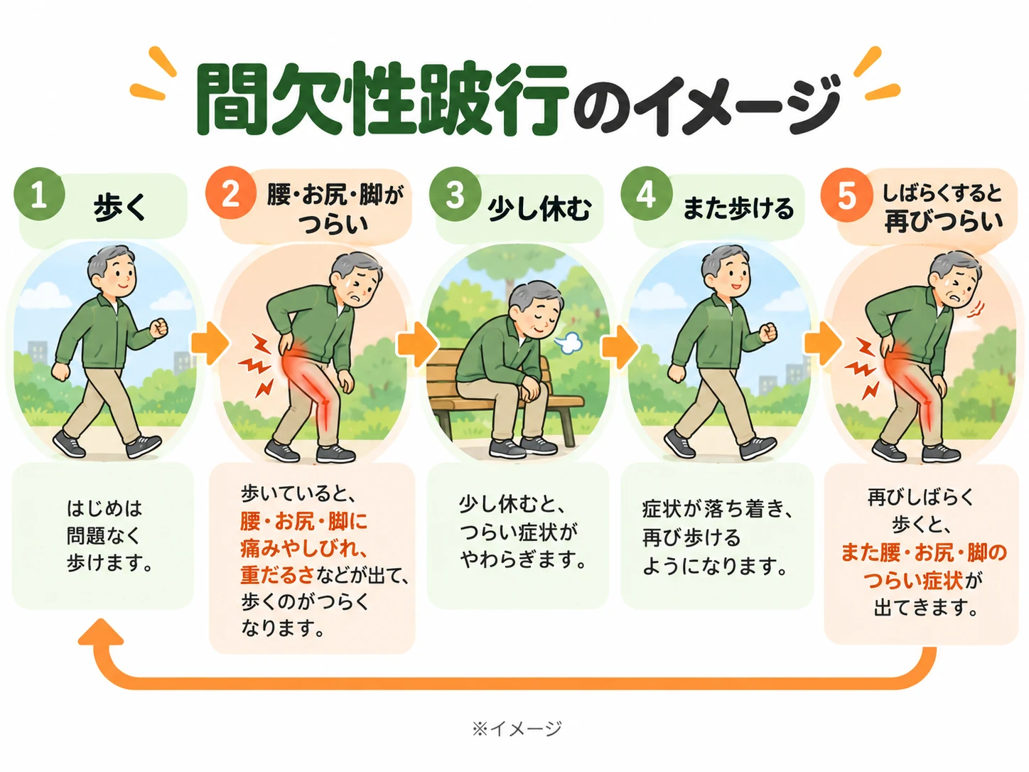 間欠性跛行の歩行サイクル。歩くと腰・お尻・脚がつらくなり、休むと和らいで再び歩けるようになる様子を示す5段階のイラスト